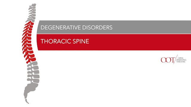 Thoracic spine - Degenerative Disorders