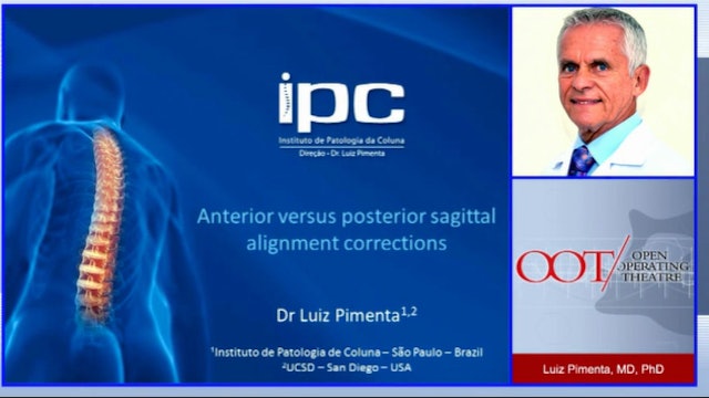Anterior versus posterior sagittal alignment corrections