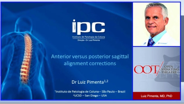 Anterior versus posterior sagittal alignment corrections