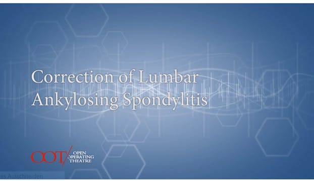 Masterclass 3.2 Correction of lumbar ankylosing spondylitis