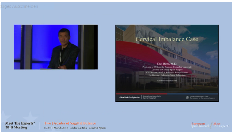 Cervical imbalance; case presentation