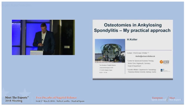 Osteotomies in ankylosing spondylitis - my practical approach