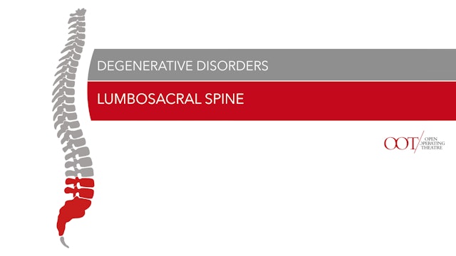 Lumbosacral spine - Degenerative Disorders