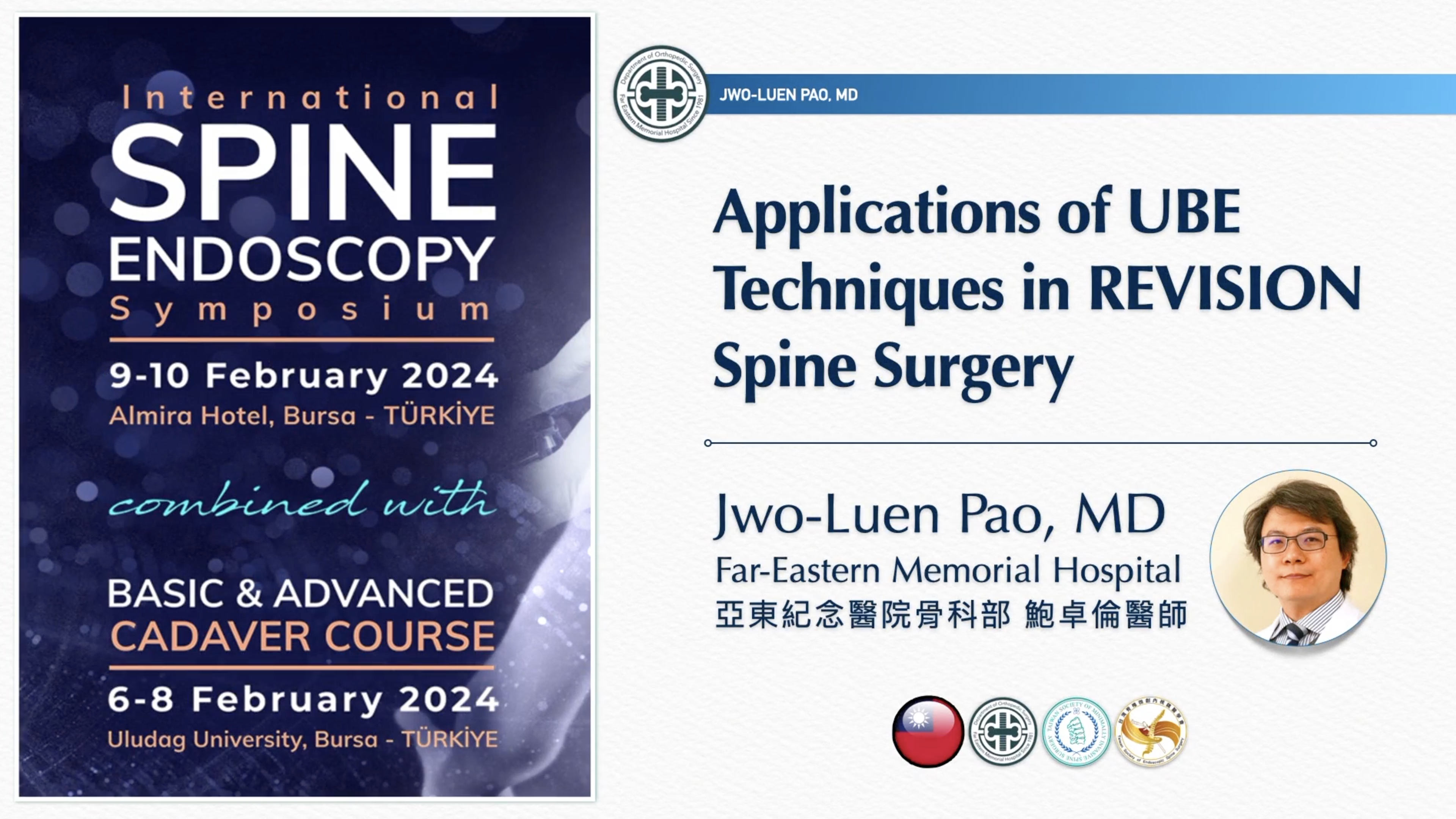 Applications of UBE techniques in Revision spine surgery