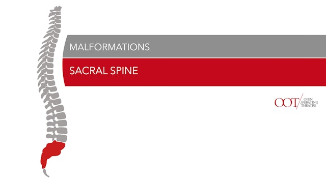 Lumbosacral spine - malformations