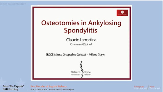 Osteotomies in ankylosing spondylitis