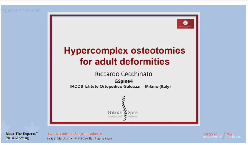 Hypercomplex osteotomies for adult deformities