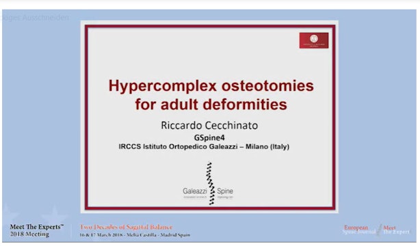Hypercomplex osteotomies for adult deformities