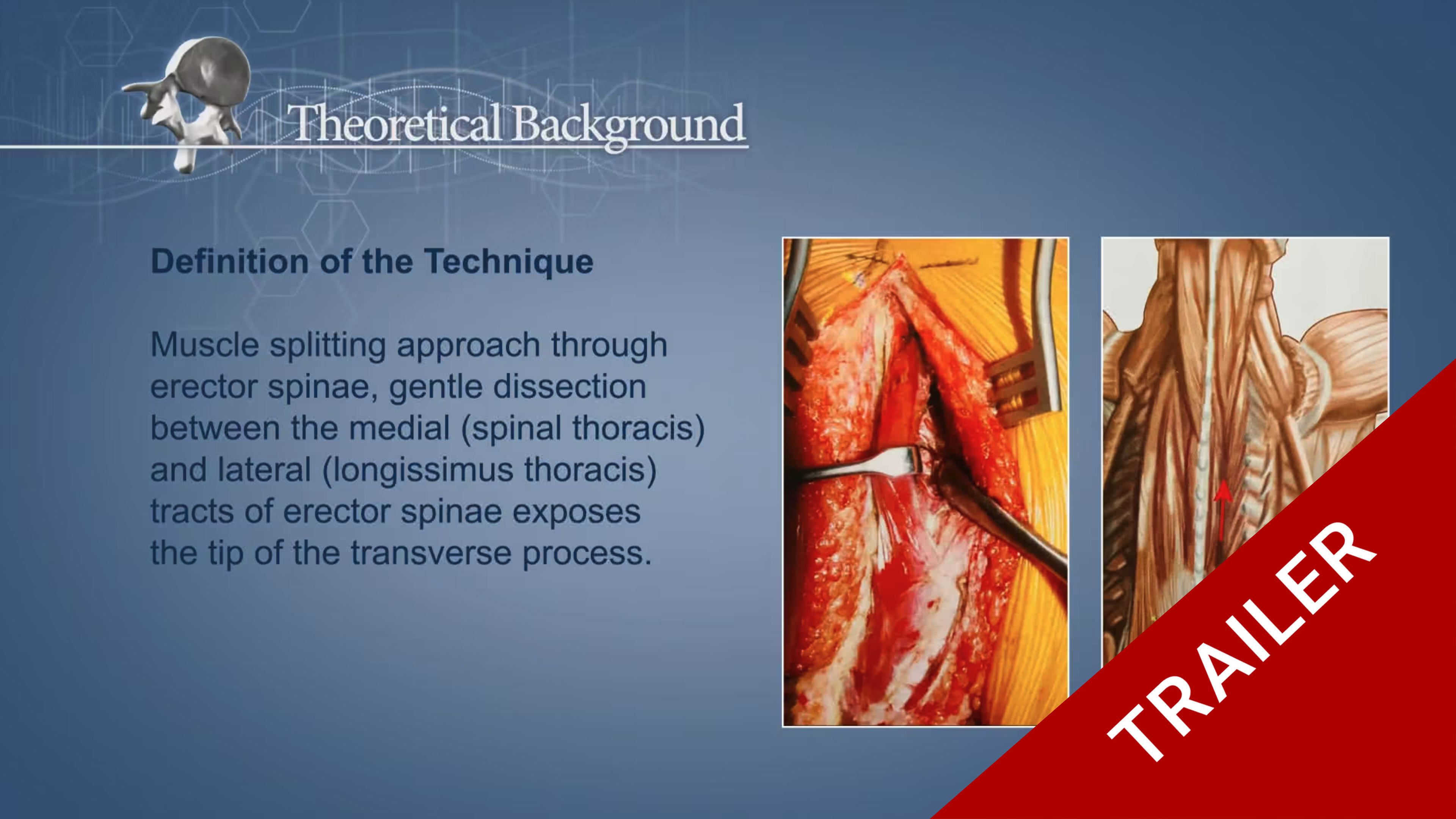 Trailer Less invasive instrumentation and correction in paediatric deformity