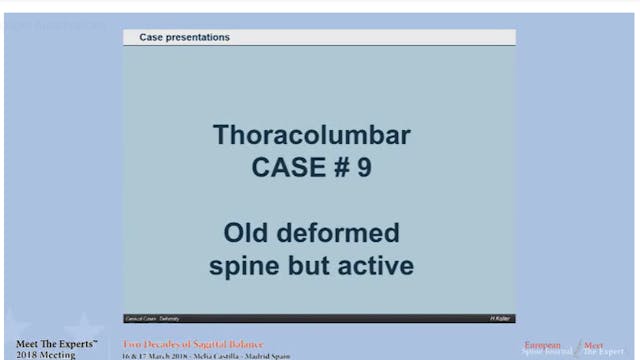 Old deformed spine but active; case p...