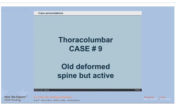 Old deformed spine but active; case presentations