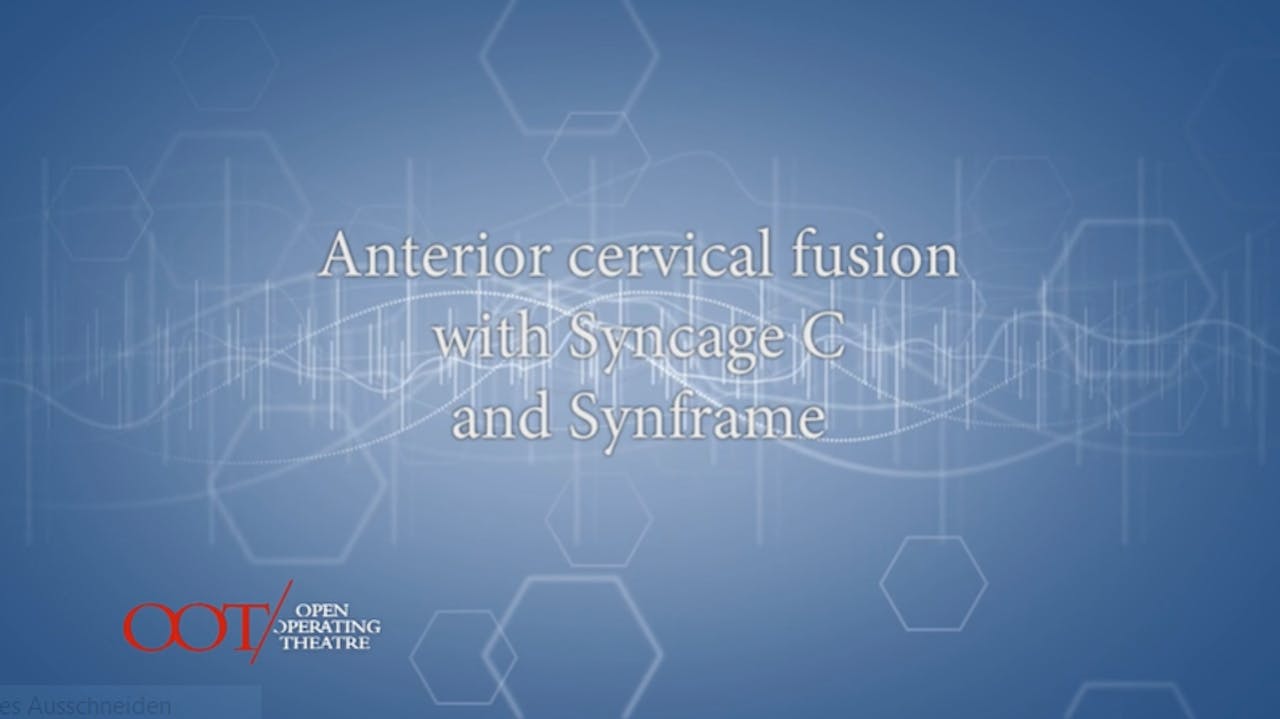 Synframe Masterclass 1.3 Anterior cervical fusion with Syncage C and Synframe ...