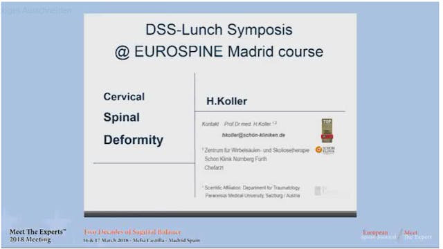 Cervical spine deformity; case presen...
