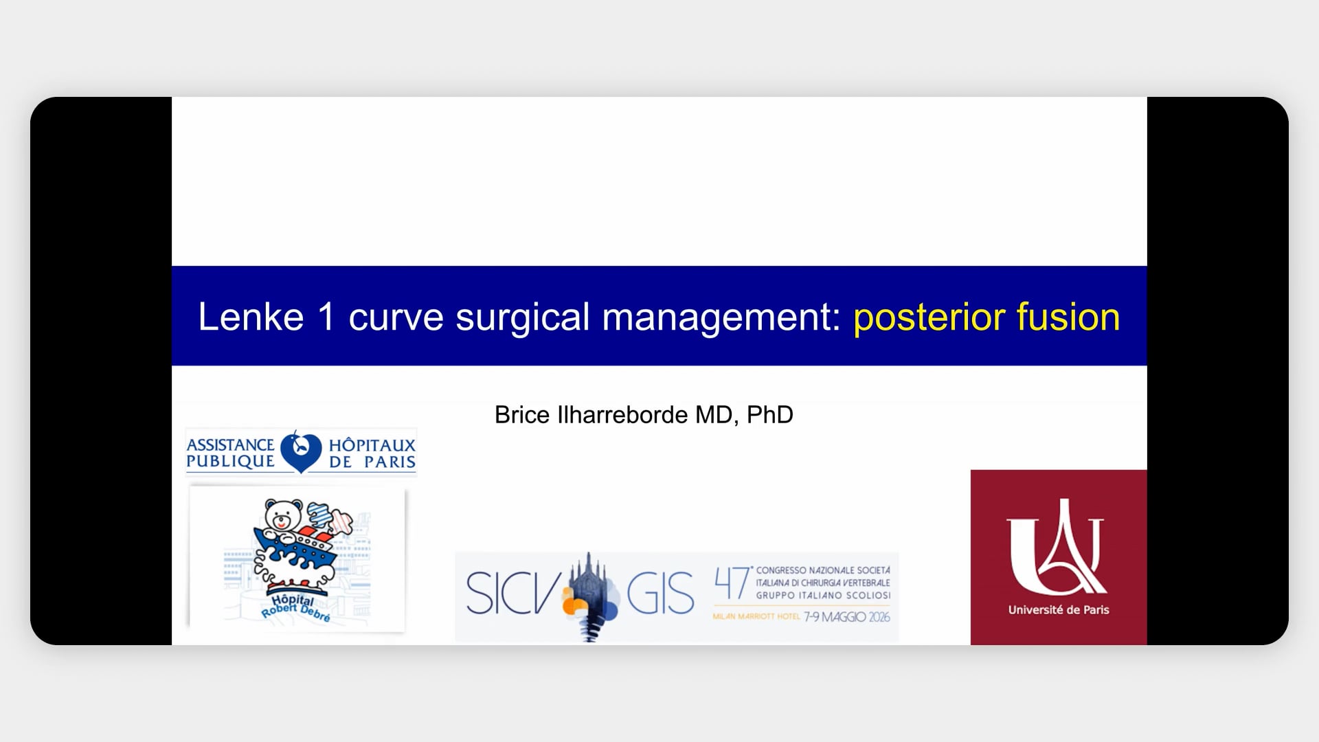 Lenke 1 Curve surgical Management: Posterior Fusion
