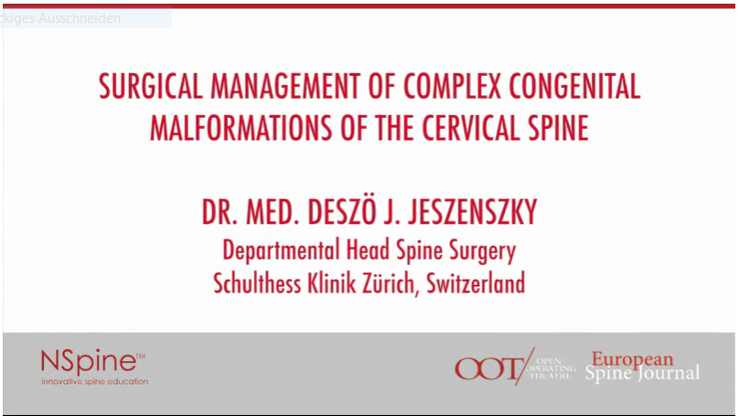 Surgical management of complex congenital malformations of the cervical spine