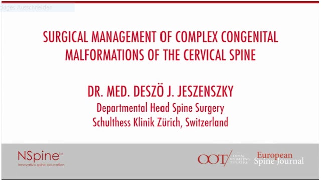 Surgical management of complex congenital malformations of the cervical spine
