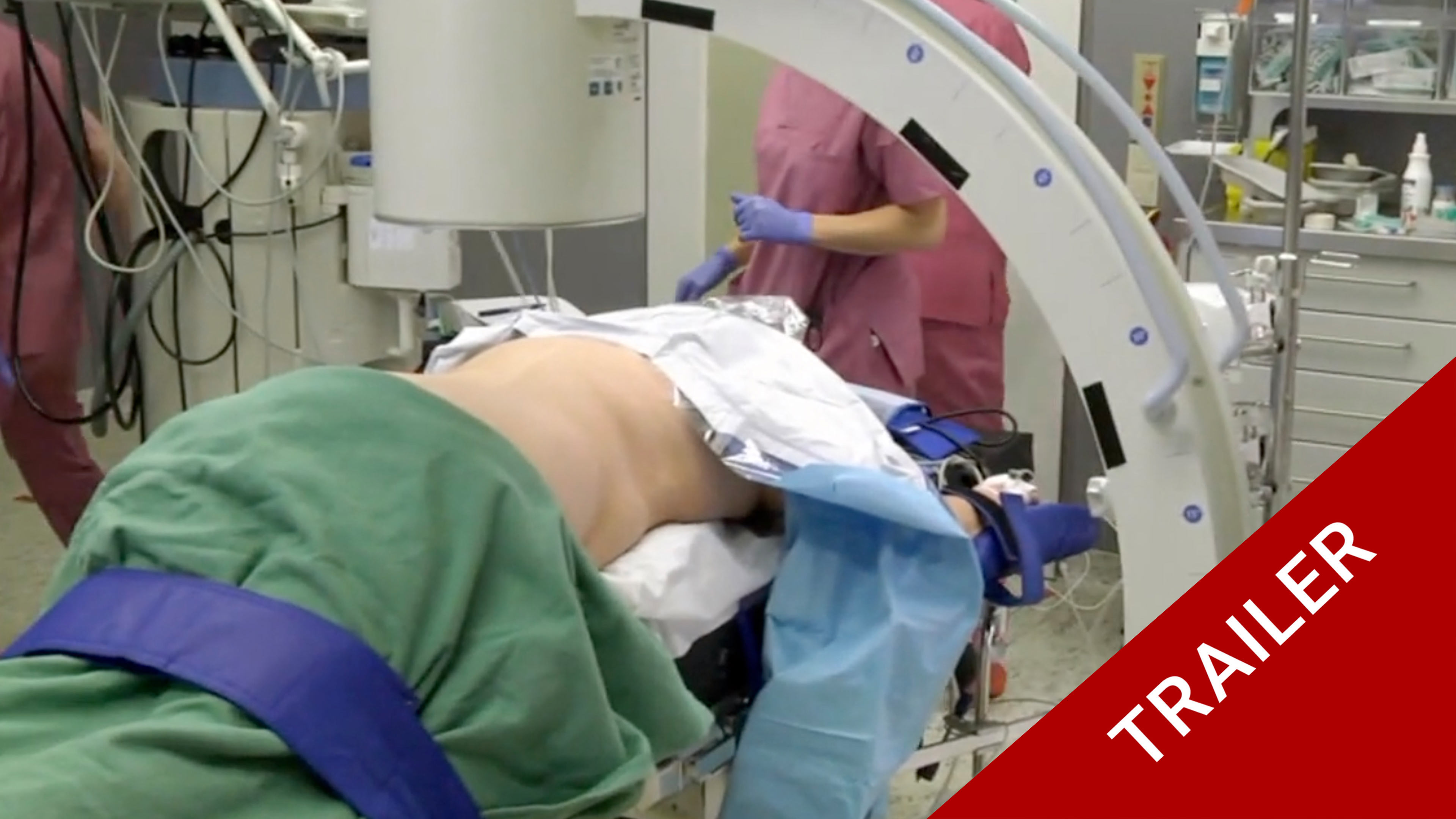 Trailer TPLIF in degenerative spondylolisthesis L4/5