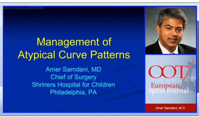 Management of atypical curve patterns