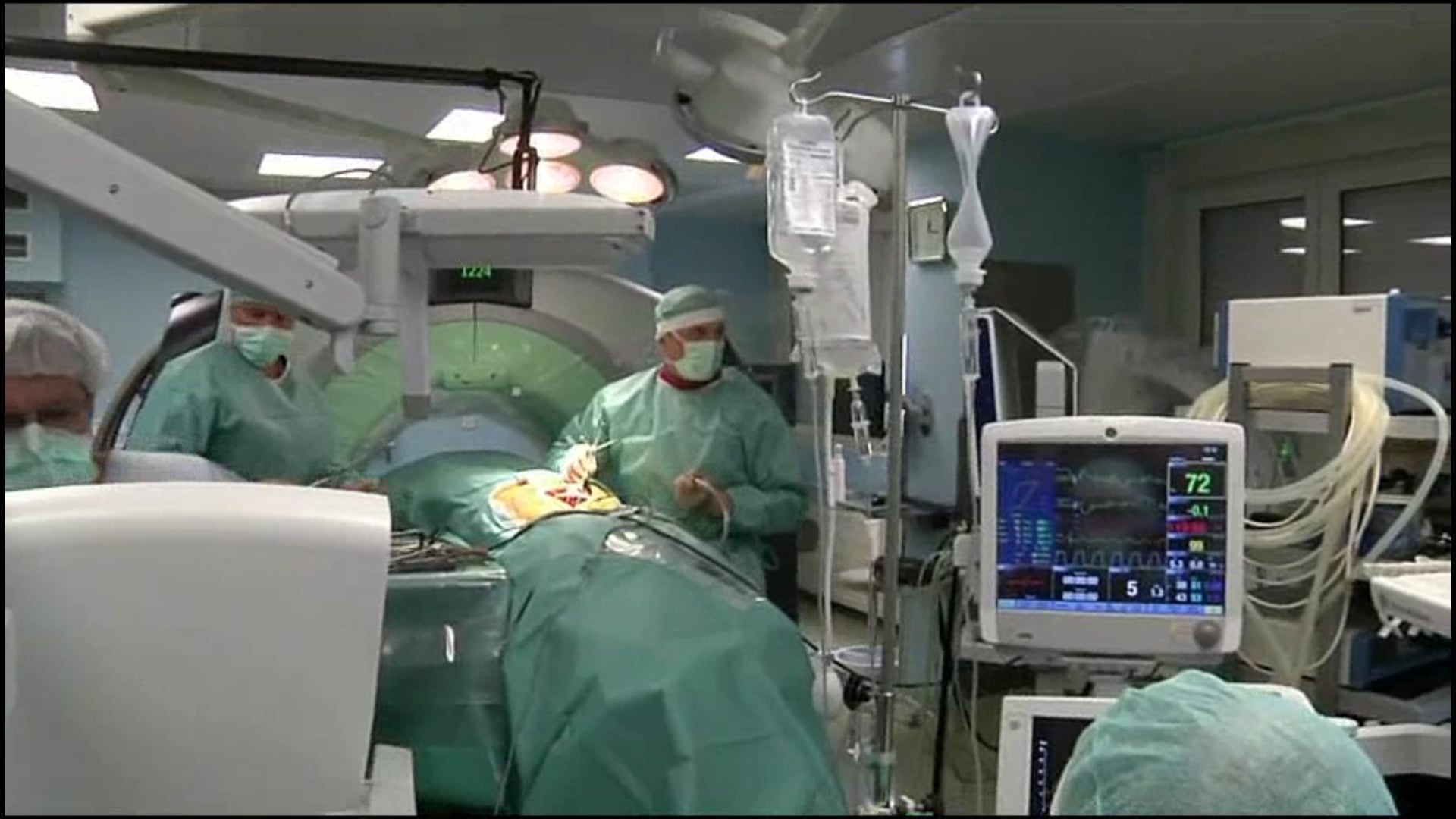Portable CT scanner-based navigation in lumbar pedicle screw insertion