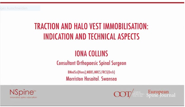 Traction and halo vest immobilisation: Indication and technical aspects