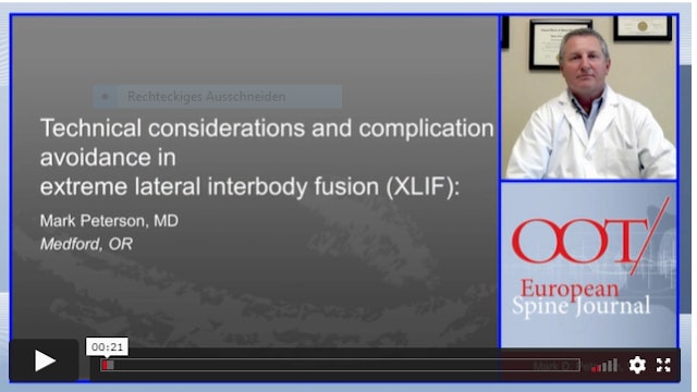 Technical considerations and complication avoidance in extreme lateral interbody