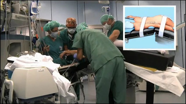 Less invasive approach in degenerative lumbar deformity surgery