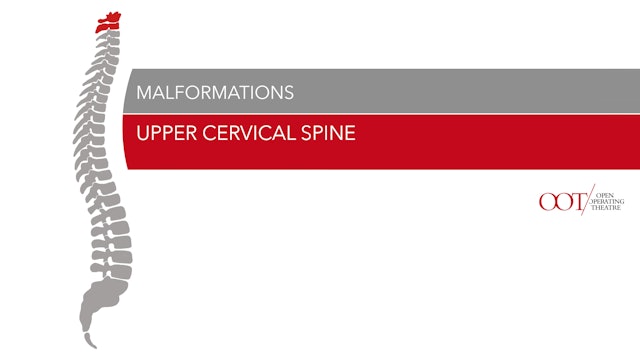 Upper cervical spine - Malformations