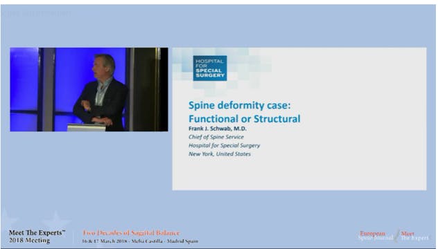 Spine deformity case: functional or s...