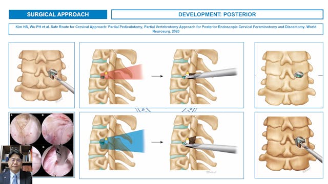 Anatomical consideration of posterior...