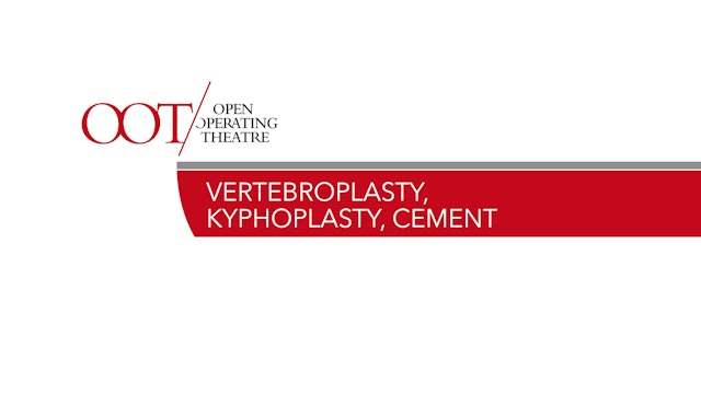 Vertebroplasty, Kyphoplasty, Cement