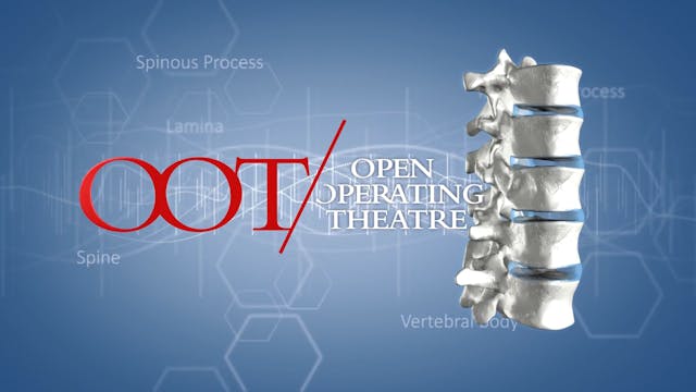 Correction and spinal fusion Th5-L4 w...