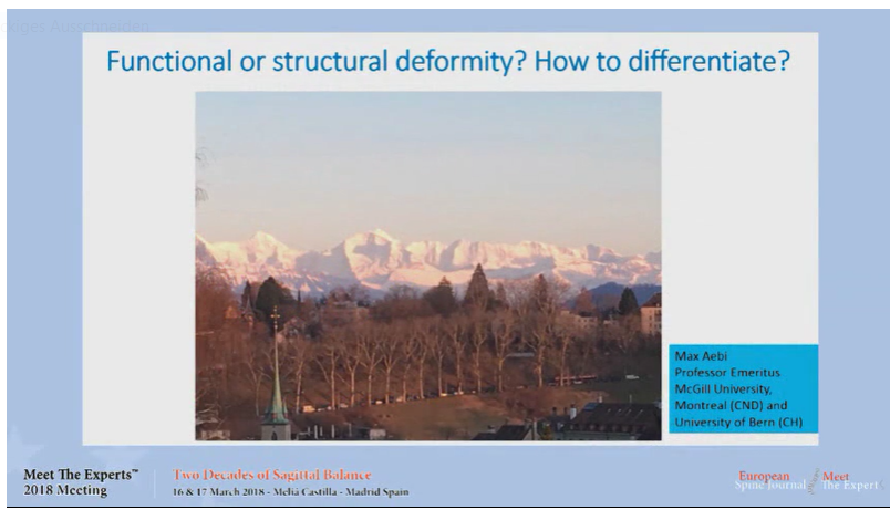 Functional or structural deformity? How to differentiate?