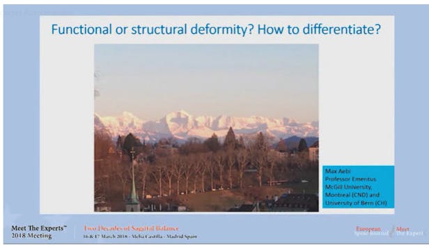 Functional or structional deformity? ...
