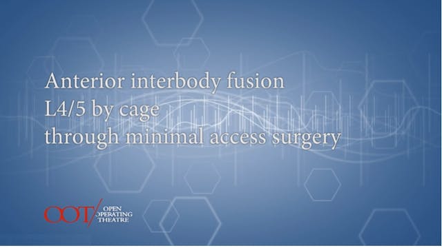 Masterclass 1.2 Ant. interbody fusion L4/5 by cage through minimal access...