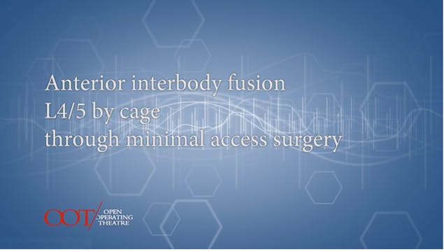 Masterclass 1.2 Ant. interbody fusion L4/5 by cage through minimal access...