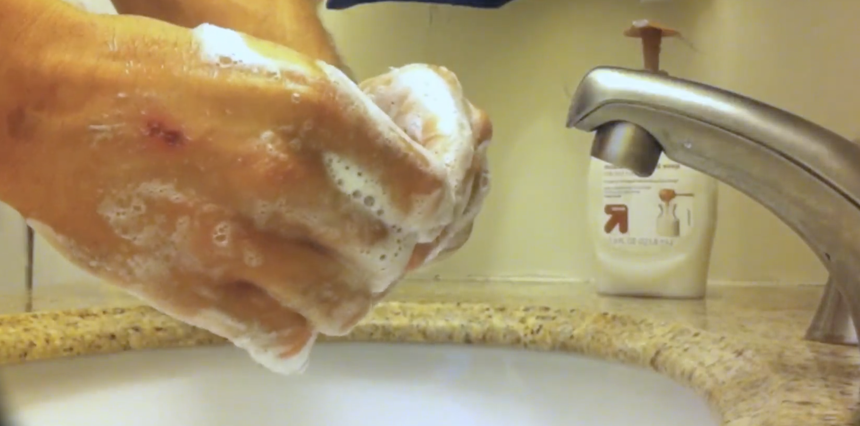 Bloodborne Pathogens