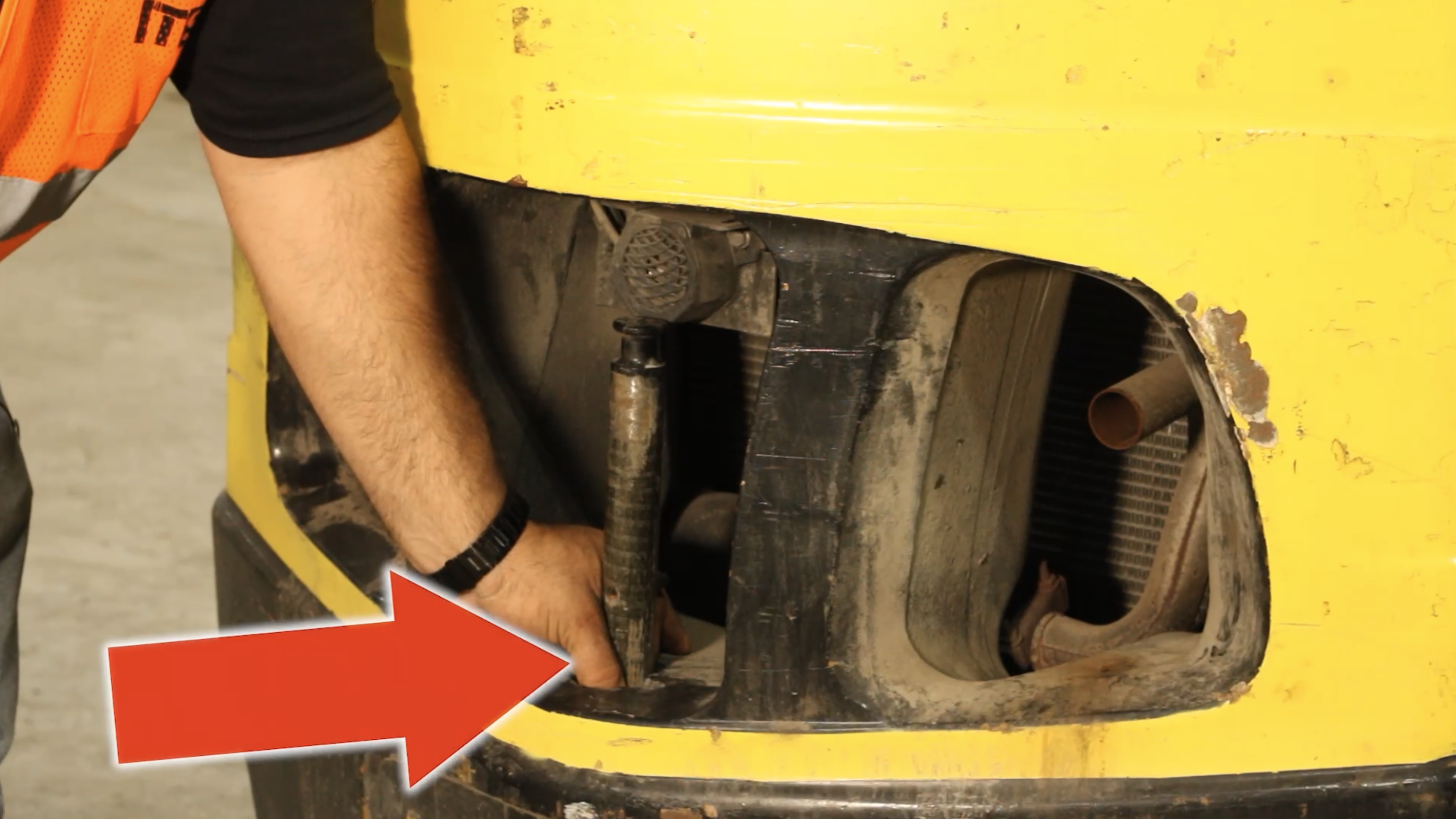 0062 E - True Story - Thumb Severed off by Hitch of Forklift - Ernie Moreira