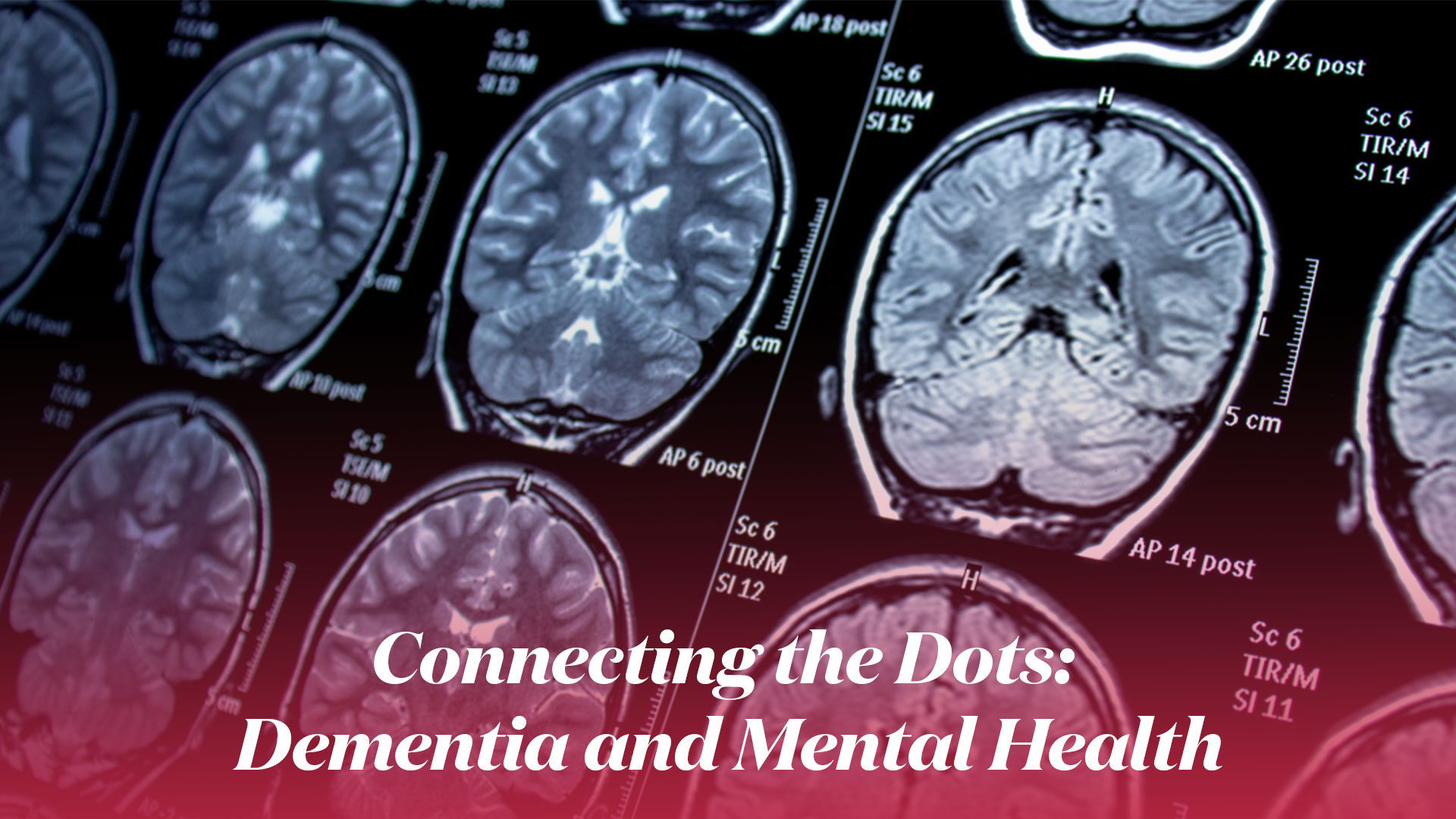 Connecting the Dots: Dementia and Mental Health