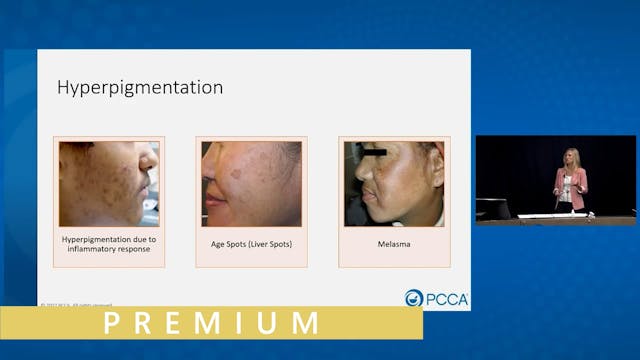 Common Conditions (Hyperpigmentation,...