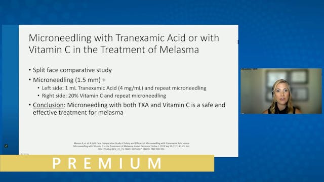 Hyper and Hypopigmentation- Solutions...