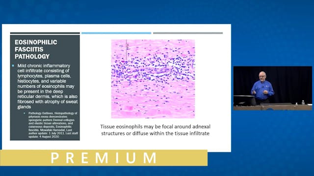 Demystifying Dermatology One Disease ...