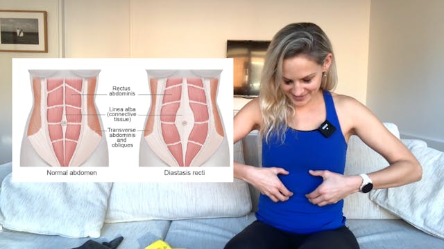 Abdominal Separation