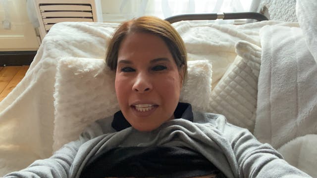 After liposuction