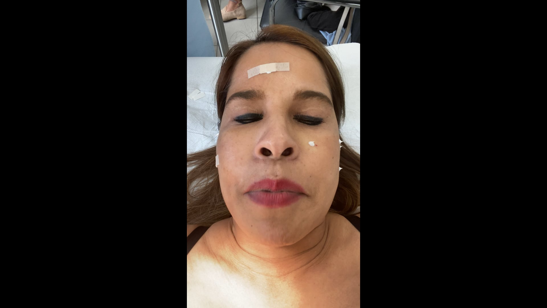 On the table at the plastic surgeon