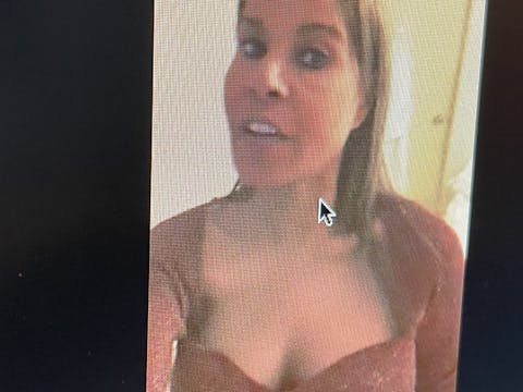 Itchy top
