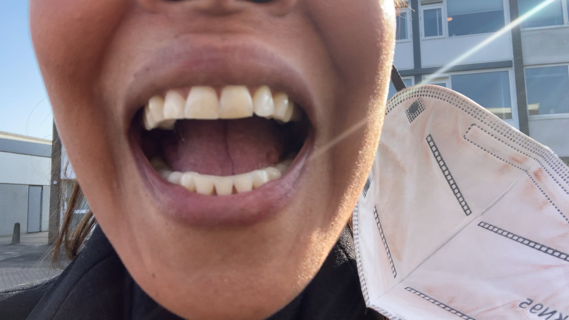 A fix from the Dentist