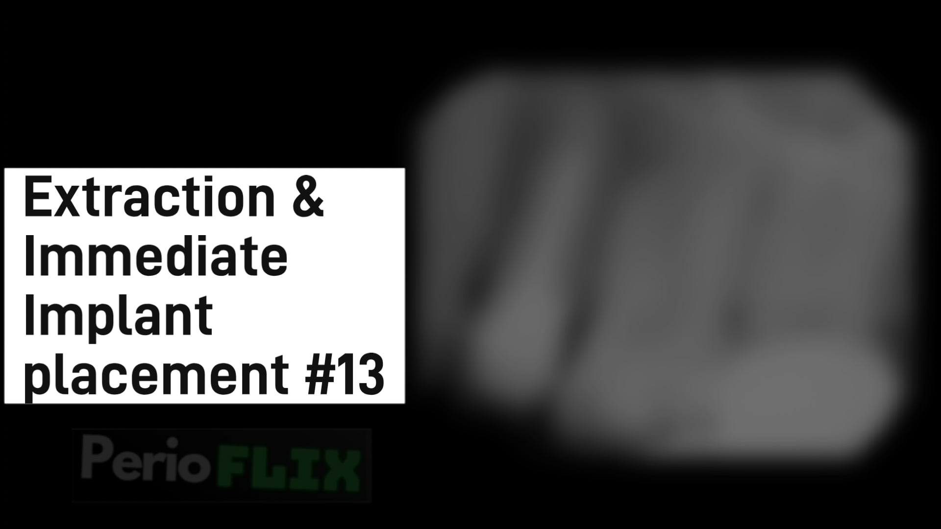PerioFLIX Video