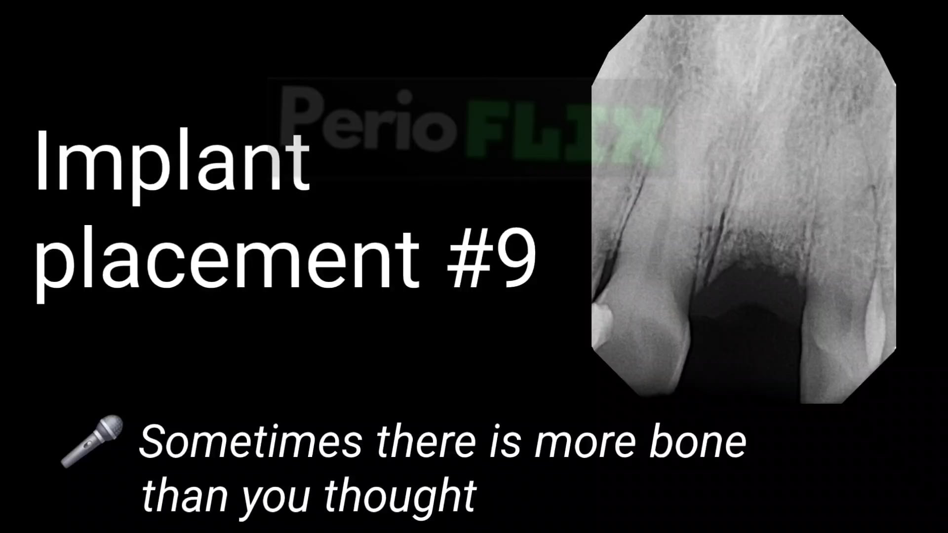 PerioFLIX Video