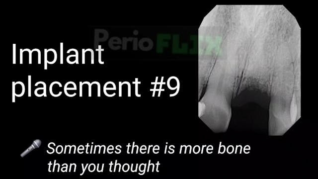 Implant placement #9