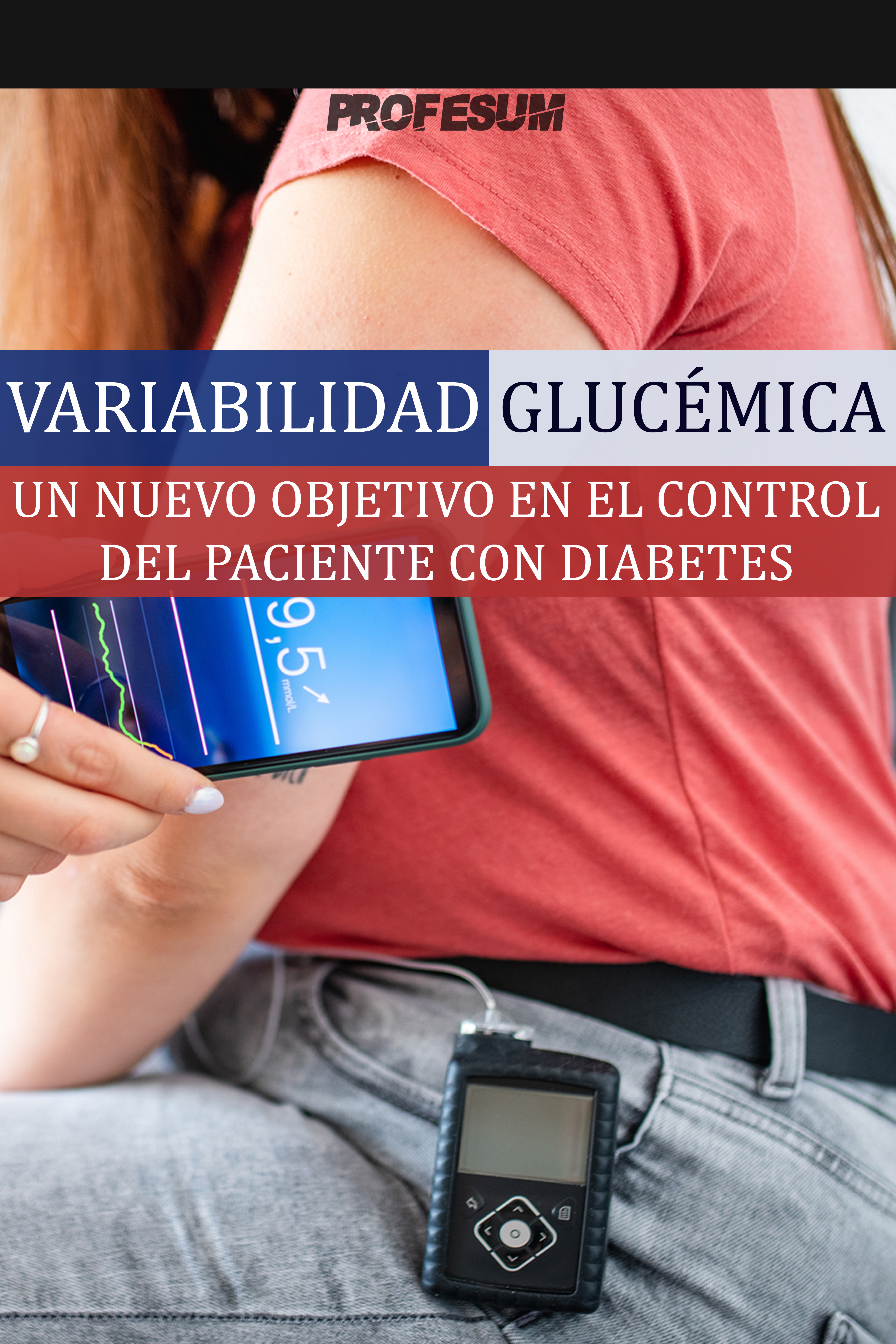 Variabilidad Glucémica